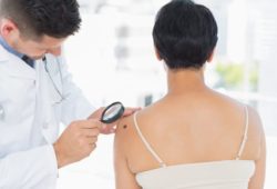 Dermatologist using a magnifying glass to examine an atypical mole on a woman’s shoulder