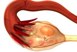 An illustration of a typical ovary