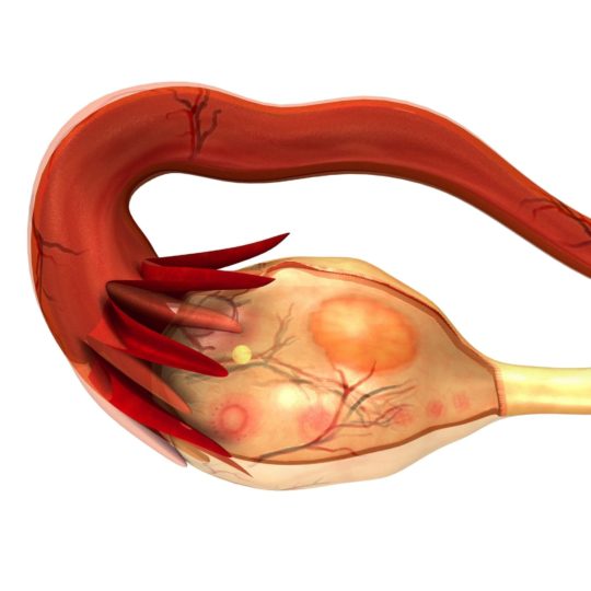 An illustration of a typical ovary
