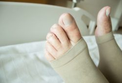 Close up shot of woman wearing deep vein thrombosis stockings on her feet