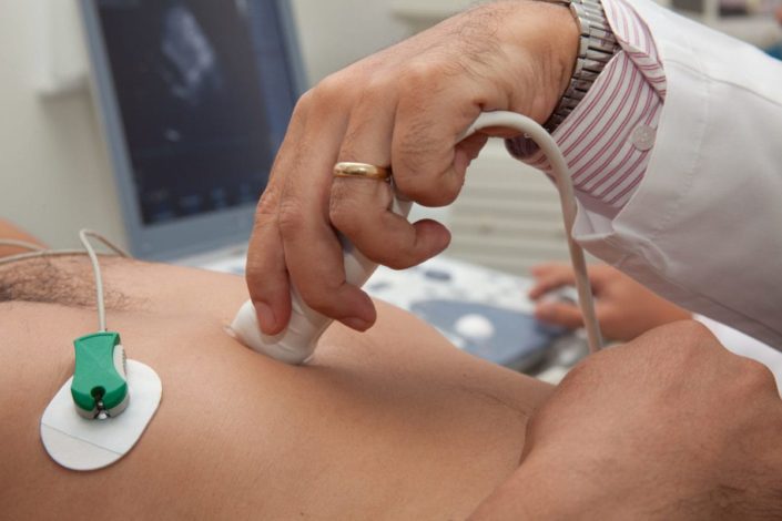 doctor performs an echocardiogram to check the heart