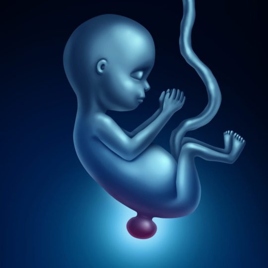 3D illustration of a fetus who has spina bifida, a neural tube defect