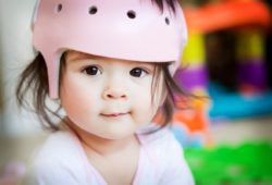 A baby girl wearing a medical helmet who has plagiocephaly smiling at the camera