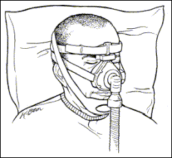 CPAP Face mask with chin strap illustration